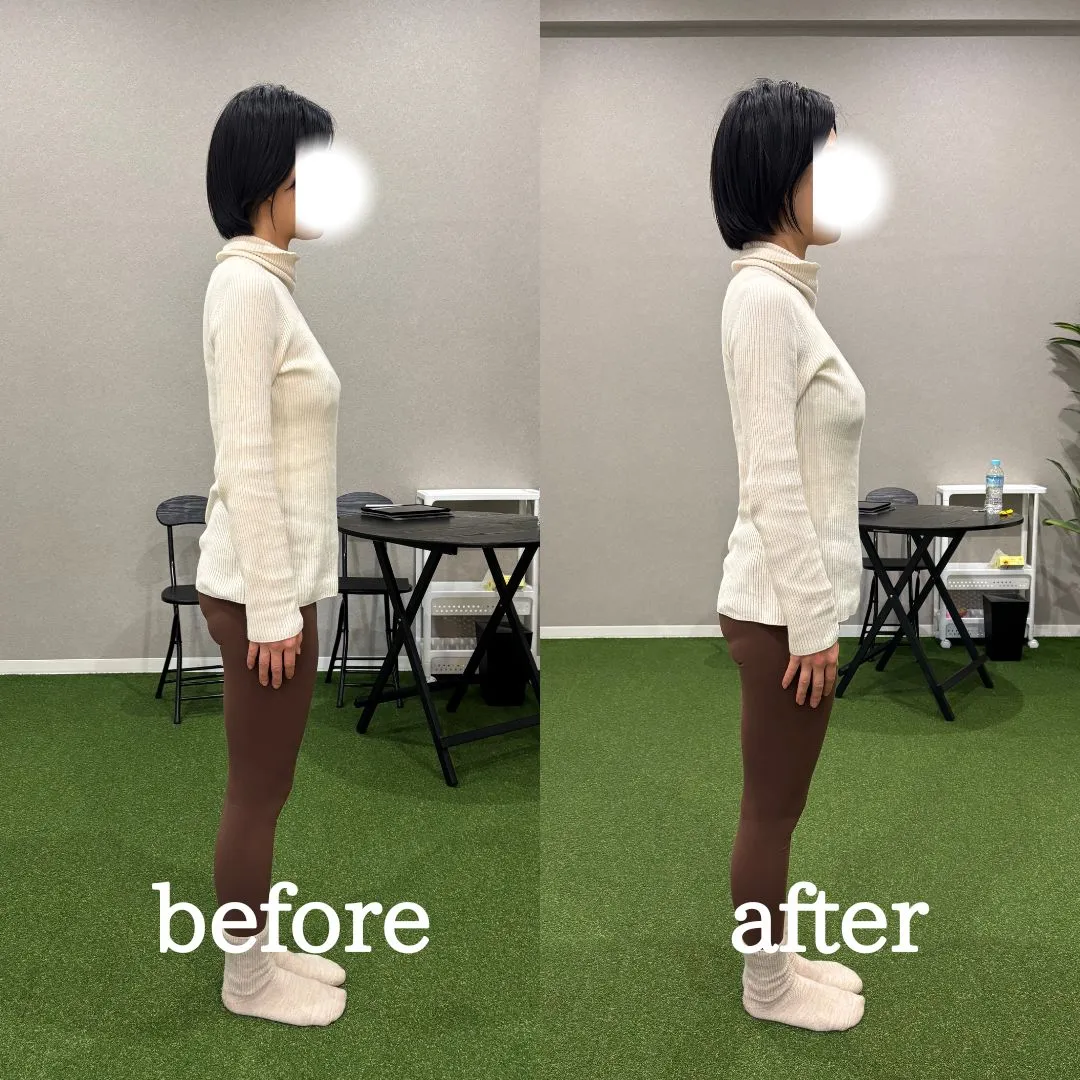 志木・新座のパーソナルジム｜トレーニングで姿勢変化をした女性のビフォーアフター１