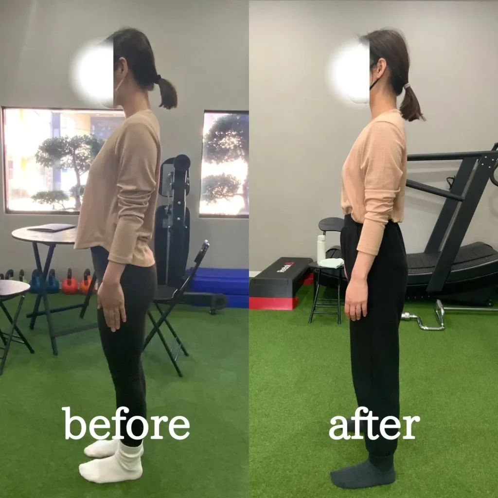 志木・新座のパーソナルジム|トレーニングで姿勢改善をした女性のビフォーアフター