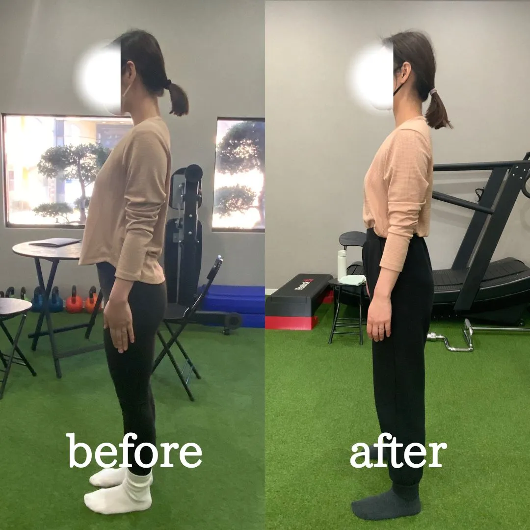 志木・新座のパーソナルジム｜トレーニングで姿勢改善をした女性のビフォーアフター